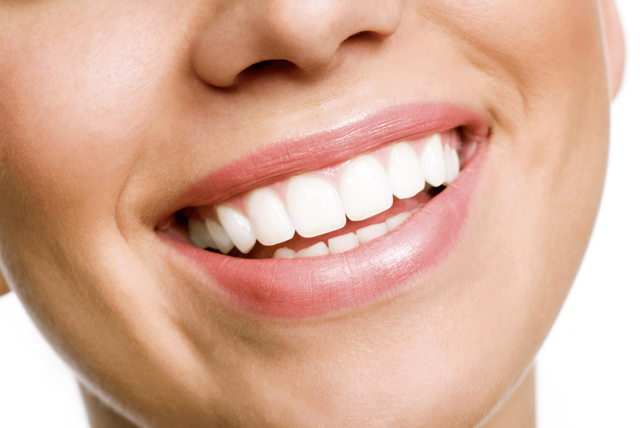 Tooth Whitening