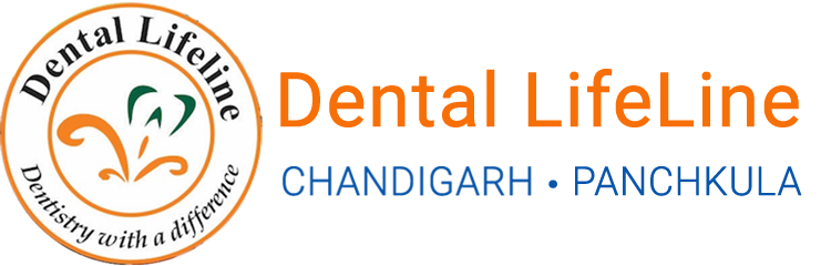 Best Endodontist in Chandigarh and Panchkula - Dental Lifeline