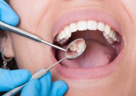 Wisdom Tooth Removal in Chandigarh