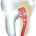 Best Root Canal Treatment in Chandigrh