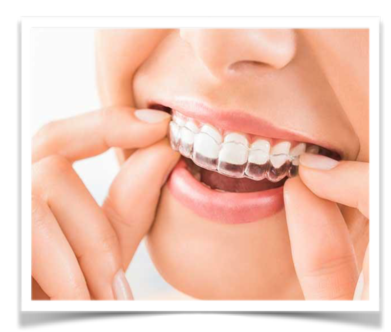 Teeth WHITENING
