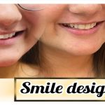 Smile Designing