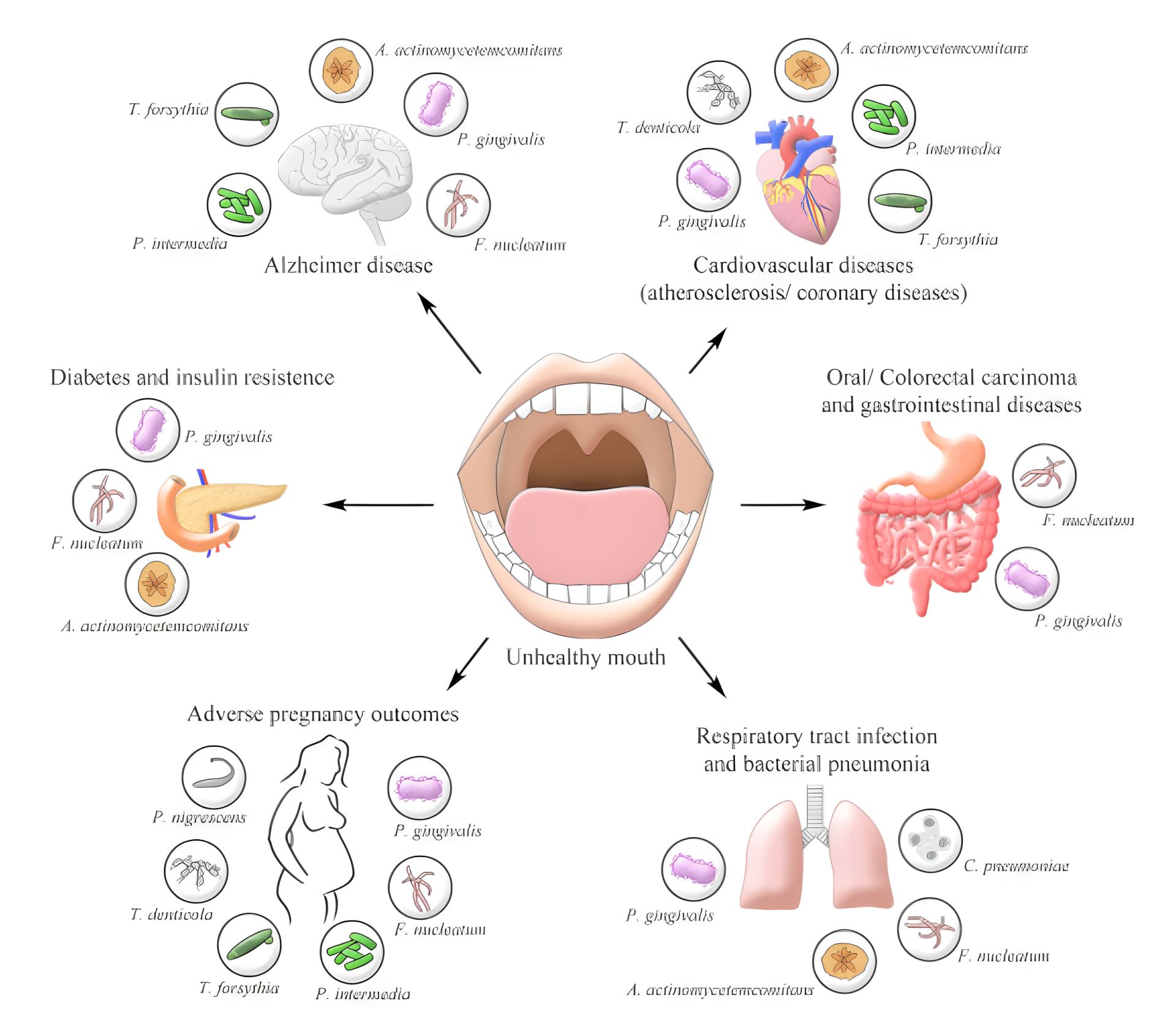 Respiratory Infections